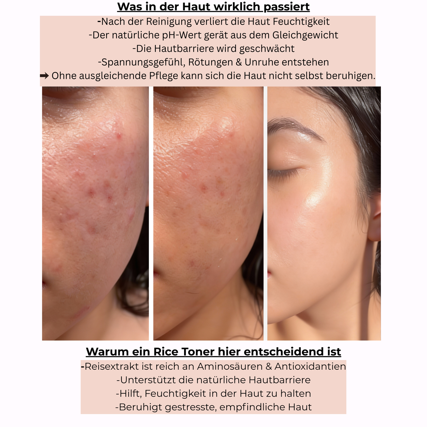 NUVORA™ Rice Toner