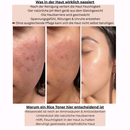 NUVORA™ Rice Toner